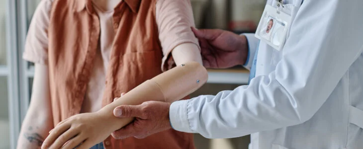 Close up of doctor fitting prosthetic arm to young woman in orthology clinic